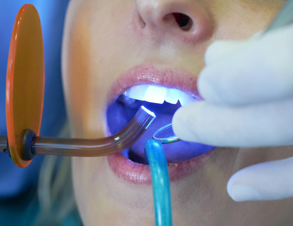 laser dentistry